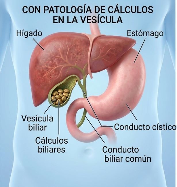 Dr. Jorge Higuerey - Especialista en cálculos vesiculares
